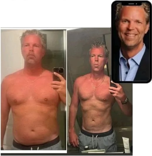Dr. Kenny Harless before and after