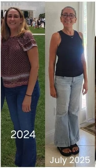 Jennifer Baydo before and after