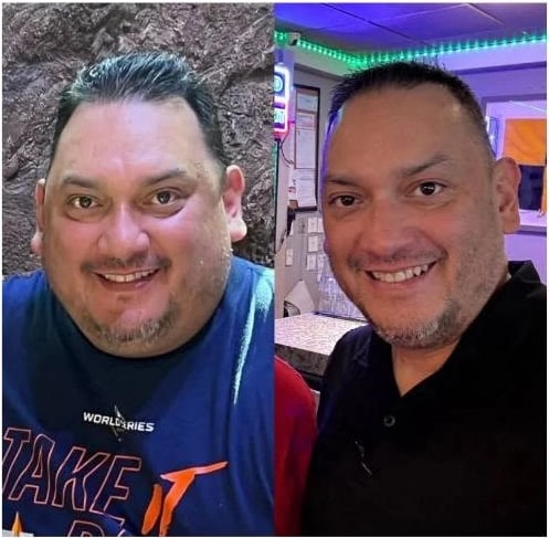 Jimmy before and after