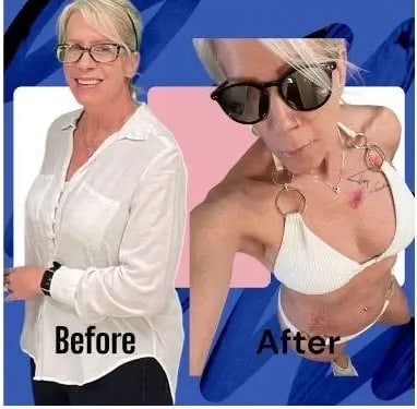 Kimberly before and after