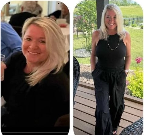 Laurie before and after